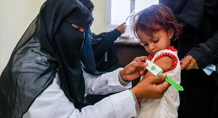 1.9 مليون طفل وامرأة يعانون من سوء التغذية في اليمن