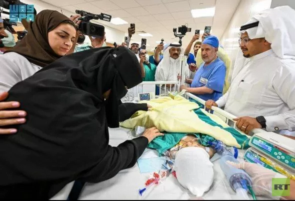 نجاح عملية فصل توأم ملتصق في السعودية (صور)