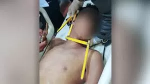 وفاة فتى يمني تحت قدمي "مشعوذ" تشعل غضبا واسعا