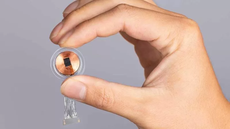 تجربة لزرع أولى شريحة دماغية في بريطانيا