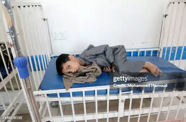 استراتيجية التجويع في اليمن