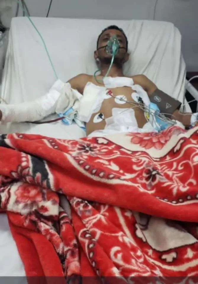 اليمن: أحد أبطال الكونغ فو ينجو من الموت إثر القصف الصاروخي على صنعاء