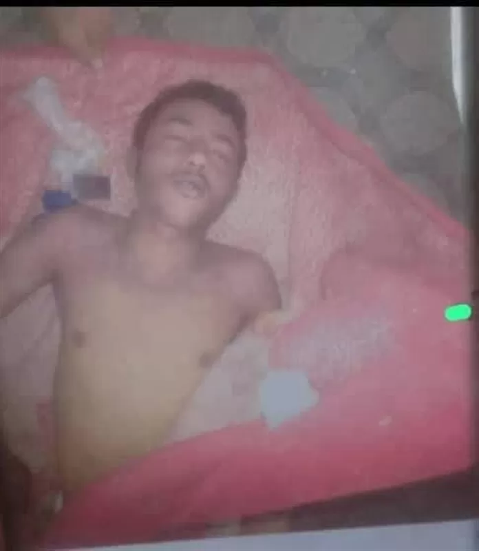 اليمن: وفاة شاب تحت التعذيب في سجون الحوثيين بمحافظة عمران